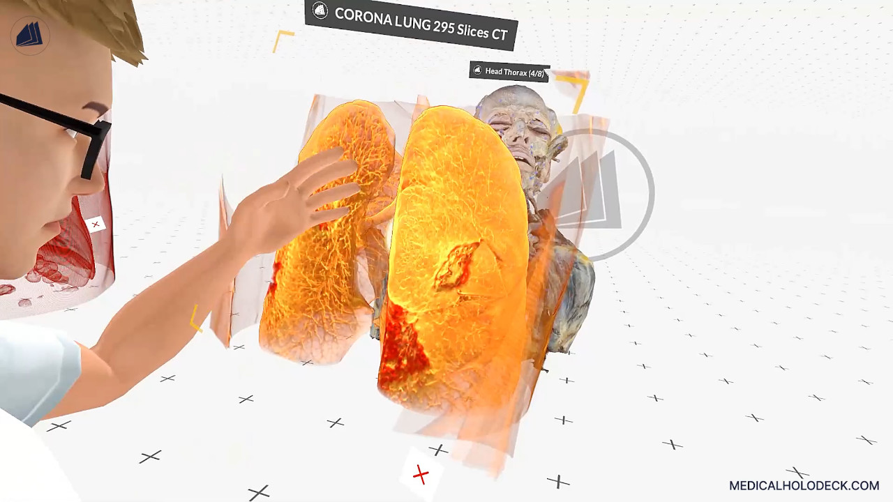 Exploring the human lungs thumbnail 4